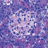 Group of cells in the pancreas that produce insulin