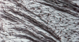 Mô sợi (mũi phôi lợn)