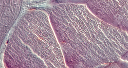 Gân (mặt cắt dọc)