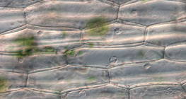 Tế bào biểu bì thực vật