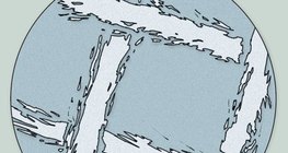 Hình ảnh hiển vi của gạc