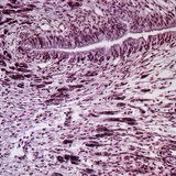 Mặt cắt chân ốc