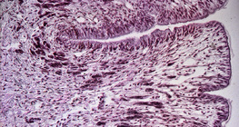 Mặt cắt chân ốc