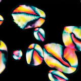 Hạt tinh bột trong khoai tây