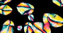 Hạt tinh bột trong khoai tây