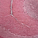 Phần tiểu não của con người