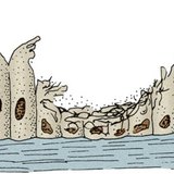 Biểu mô bị cắt của đường hô hấp của người hút thuốc