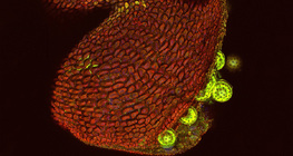 Bao phấn hoa Mirabilis, mở ra (kính hiển vi quét laser đồng tiêu)