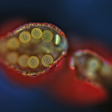 Mirabilis pollen sack, opened (optical microscope)
