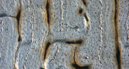 Xương (mặt cắt dọc)