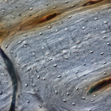 Xương (mặt cắt dọc)