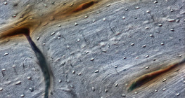 Xương (mặt cắt dọc)