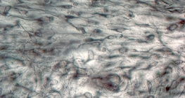 Mô liên kết lỏng lẻo