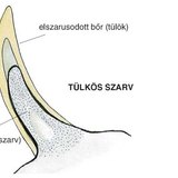 Tülkös szarv