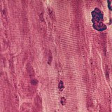 Mozgatóideg-végződések a vázizomban