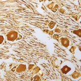 Nerve cells in the spinal ganglion