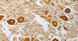 Các tế bào thần kinh trong hạch thần kinh cột sống