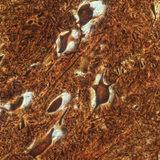 Các tế bào thần kinh trong tủy sống (gia súc)