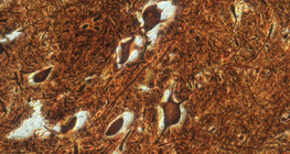 Các tế bào thần kinh trong tủy sống (gia súc)