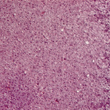 tuyến thượng thận