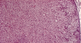 tuyến thượng thận