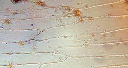 Các tế bào của lá vảy thịt của hành tây