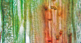 Mô mạch máu thực vật (thân bầu)