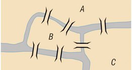 Bảy cây cầu của Königsberg