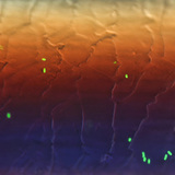 Vi khuẩn E.coli huỳnh quang trên tóc