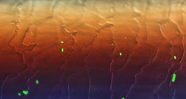 Vi khuẩn E.coli huỳnh quang trên tóc