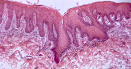 Mặt cắt ngang của lưỡi người