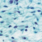 Mô liên kết lỏng lẻo