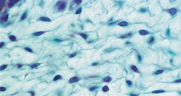 Mô liên kết lỏng lẻo