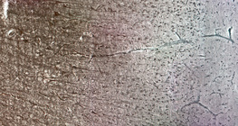 Vỏ não của con người với các lớp tế bào khác nhau