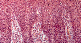 Mặt cắt ngang của lưỡi người