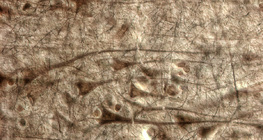 Vỏ não của con người với các tế bào hình chóp khổng lồ