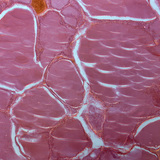 Phần của tuyến giáp