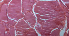 Phần của tuyến giáp