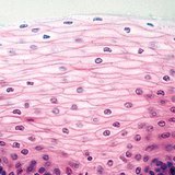 Squatous không keratinised phân tầng