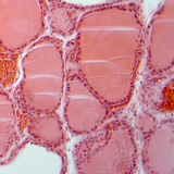 Phần của tuyến giáp