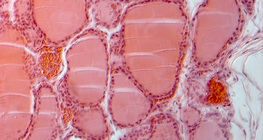 Phần của tuyến giáp