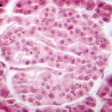 Tuyến tụy (hình ảnh tương phản pha) - các tế bào đảo Langerhans mờ hơn