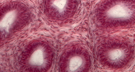 Phần của ống dẫn tinh