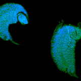 Ấu trùng Iichneumon ong phát triển như một ký sinh trùng trong con nhộng
