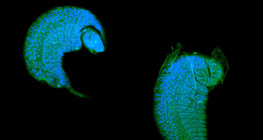 Ấu trùng Iichneumon ong phát triển như một ký sinh trùng trong con nhộng