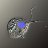 Tác nhân gây bệnh của trùng roi âm đạo (hình ảnh tương phản nhiễu, hạt nhân được nhuộm màu xanh)