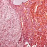 Tuyến yên (mặt cắt dọc, độ phóng đại thấp)