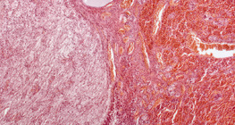 Tuyến yên (mặt cắt dọc, độ phóng đại thấp)