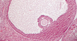 Mặt cắt ngang của buồng trứng (động vật có vú)