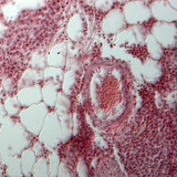 Section of human lung